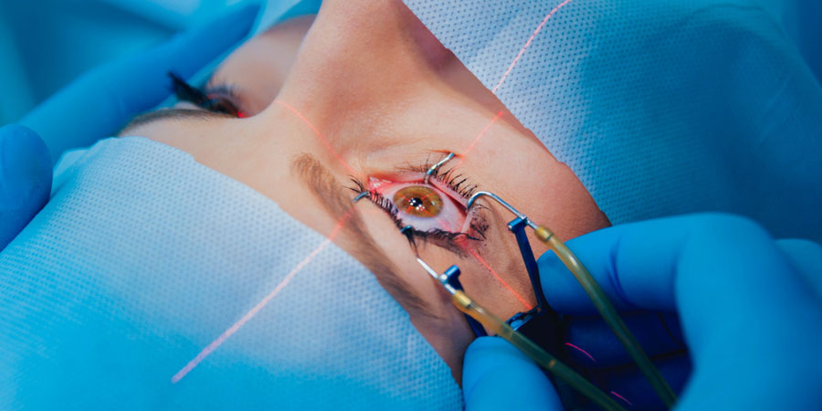 Blade Free Lasik