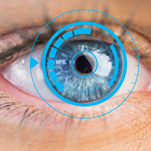 Cornea Transplantation (Keratoplasty) Cornea Transplantation (Keratoplasty)