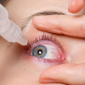 Dry Eye Treatment Dry Eye Treatment